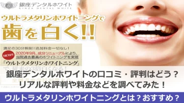 銀座デンタルホワイトの口コミがヤバいって本当？リアルな評判や料金などを調べてみた！