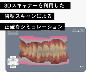 oh my teethのマウスピース