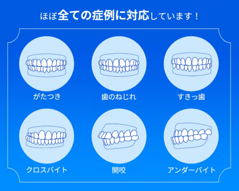 ゼニュムの矯正可能な症例