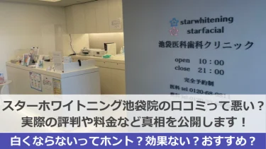 スターホワイトニング池袋医科歯科クリニックの口コミは最悪？「白くならない」という声はホント？