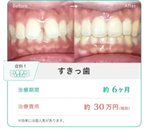 hanaraviの症例