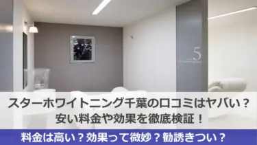 スターホワイトニング千葉スター歯科の口コミはヤバい？安い料金や効果を徹底検証！
