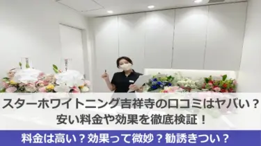 スターホワイトニング吉祥寺スター歯科の口コミはヤバい？安い料金や効果を徹底検証！