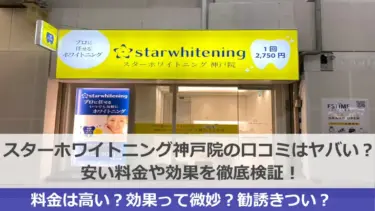 スターホワイトニング神戸三宮スター歯科の口コミはヤバい？安い料金や効果を徹底検証！