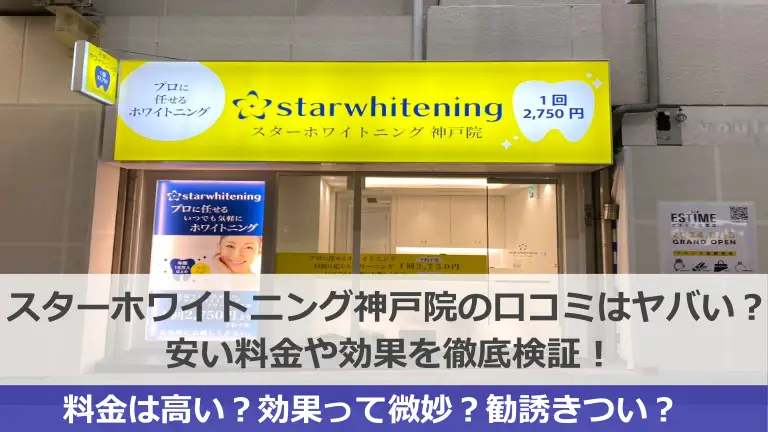 スターホワイトニング神戸三宮スター歯科の口コミはヤバい？安い料金や効果を徹底検証！