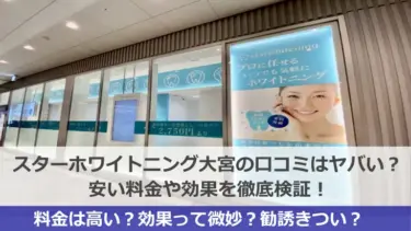 スターホワイトニング大宮スター歯科の口コミはヤバい？安い料金や効果を徹底検証！