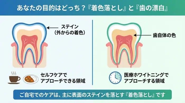 歯の断面図でセルフケアと医療ホワイトニングの違いを示したインフォグラフィック