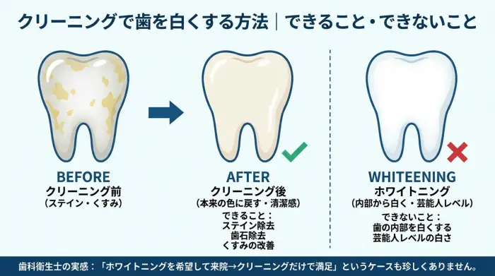 クリーニングで歯を白くする方法｜できること・できないこと