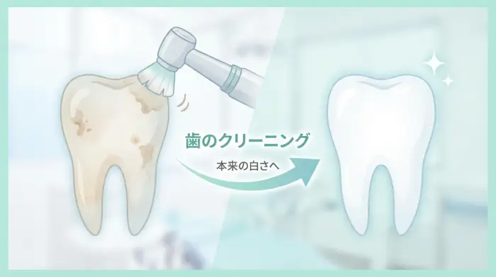 まずは結論から。クリーニングで歯は「白く見える」ようになります