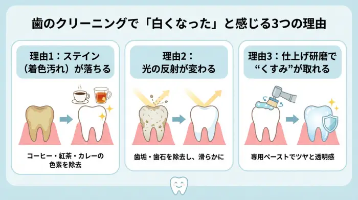 歯のクリーニングで「白くなった」と感じる3つの理由