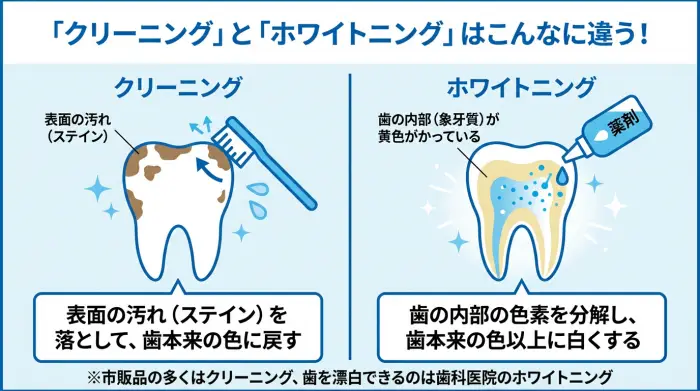 クリーニングとホワイトニングの違いを示す図解