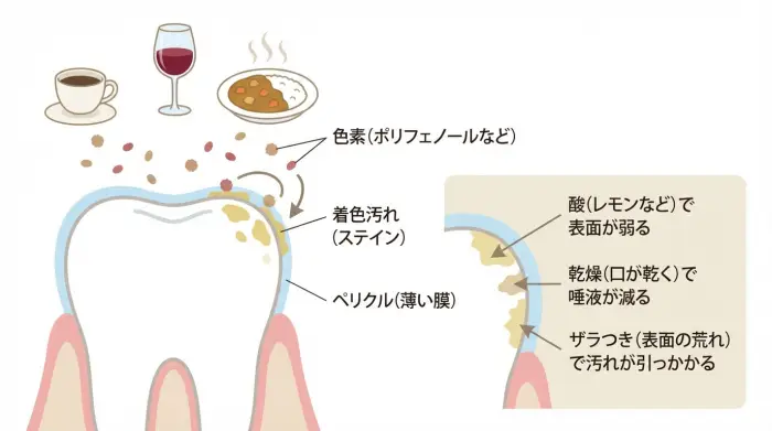 なぜ?コーヒーやカレーで歯が黄ばむ「ステイン」の正体