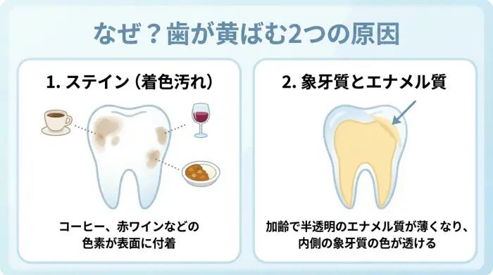 なぜ？歯が黄ばむ2つの原因と、あなたが最初に知るべきこと