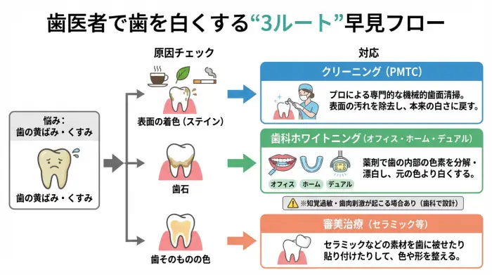 歯医者で歯を白くする方法を原因別に分けたクリーニング・ホワイトニング・審美治療の選択フロー図