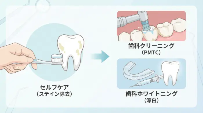 セルフの限界：ここから先は「歯科」で伸びる（クリーニング／ホワイトニング）