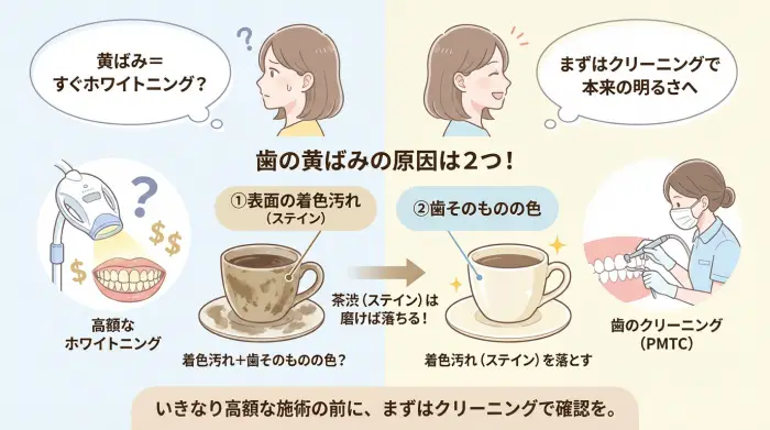 まず知ってほしい真実：「白くする＝高いホワイトニング」ではありません