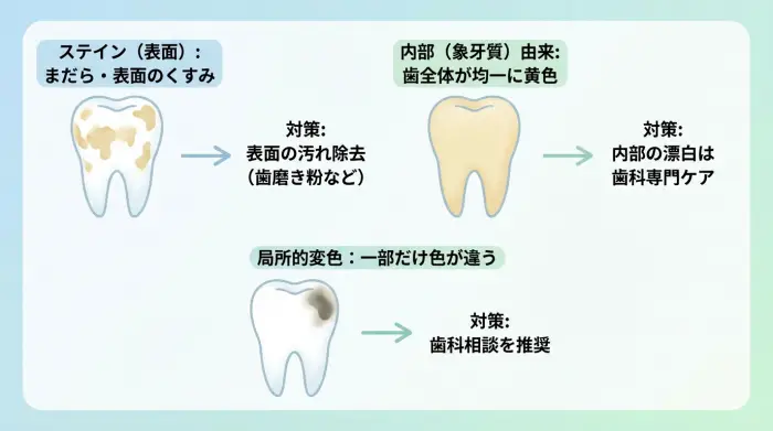 あなたの歯の黄ばみはどっち？原因別に見る最適なケア