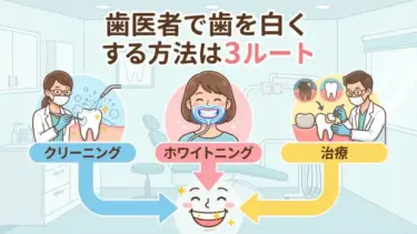 歯医者で歯を白くする方法は3ルート｜クリーニング・ホワイトニング・治療の選び方