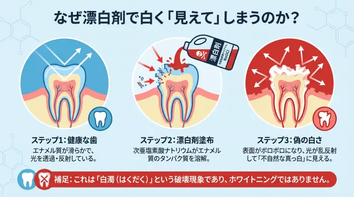 歯のエナメル質が家庭用漂白剤によって腐食し、光の乱反射で白く見える仕組みの図解