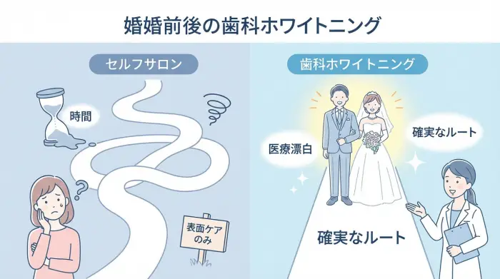 【やらなくてOK】セルフホワイトニングサロンで“時間を溶かす”のが一番もったいない