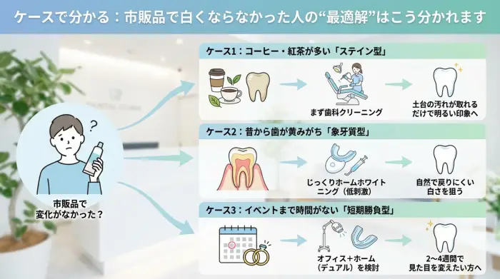 ケースで分かる：市販品で白くならなかった人の“最適解”はこう分かれます