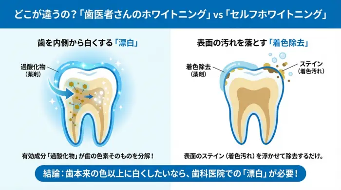 歯科医院のホワイトニングとセルフホワイトニングの違いを示す図解。歯科医院のホワイトニングは歯の内部の色素を分解して漂白するのに対し、セルフホワイトニングは表面の着色汚れを除去するに留まることを示している。