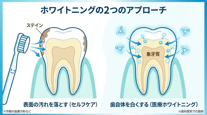 【結論】歯を白くする方法は「汚れを落とす」か「歯を白くする」かの2択です