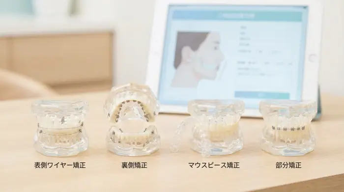 治療法は1つじゃない|出っ歯矯正の選択肢(表側・裏側・マウスピース・部分矯正)