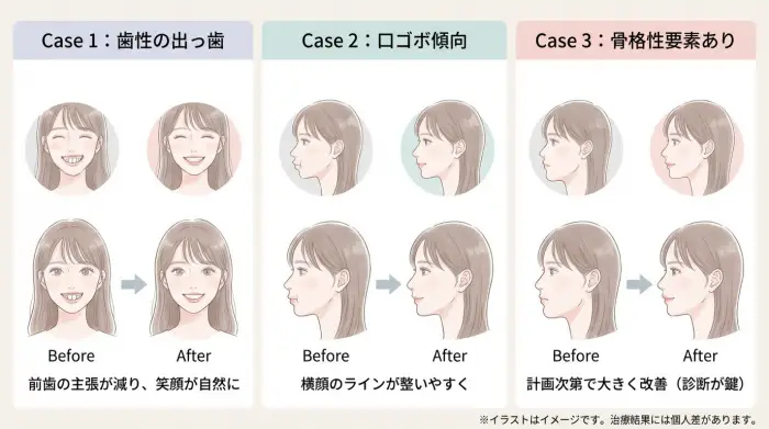 実例(ケーススタディ)|可愛く見える変化が起きた3つのモデルケース