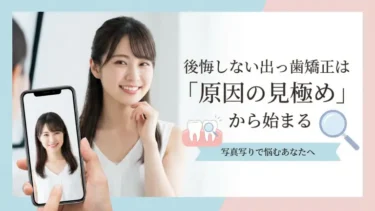 後悔しない出っ歯矯正は「原因の見極め」から始まる｜写真写りで悩むあなたへ