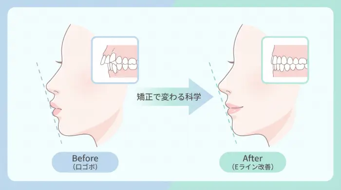 「可愛くなる」の科学：Eラインと口ゴボ改善の真実