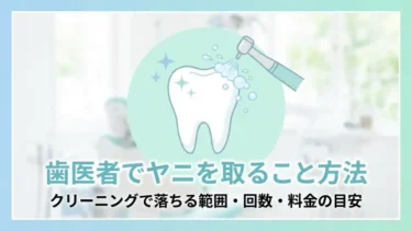 歯医者でヤニを取る方法｜クリーニングで落ちる範囲・回数・料金の目安