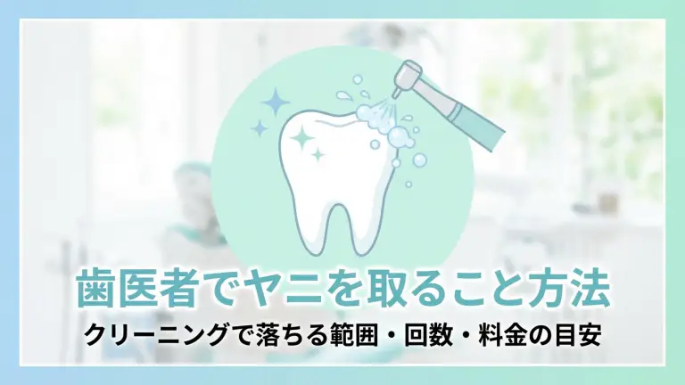 歯医者でヤニを取る方法｜クリーニングで落ちる範囲・回数・料金の目安
