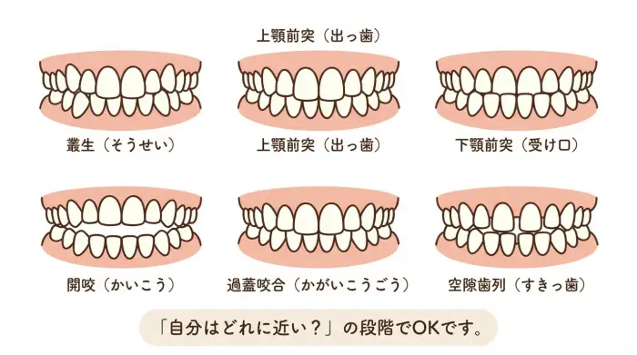 「歯並びが悪い」とは?大人のためのセルフチェック