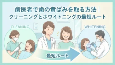 歯医者で歯の黄ばみを取る方法｜クリーニングとホワイトニングの最短ルート