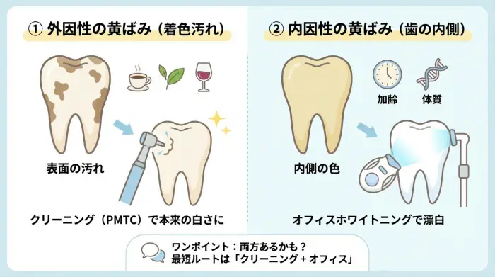 あなたの「黄ばみ」はどっち？“即日”の成功率が変わる見分け方