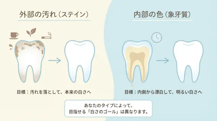 まず知りたい「歯が黄色くなる2つの原因」と「あなたが目指せる白さの限界」