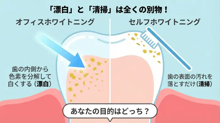 オフィスホワイトニングとセルフホワイトニングの違いを示す図解