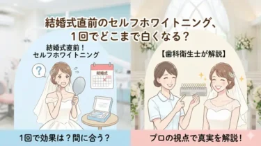 結婚式直前のセルフホワイトニング、1回でどこまで白くなる？【歯科衛生士が解説】