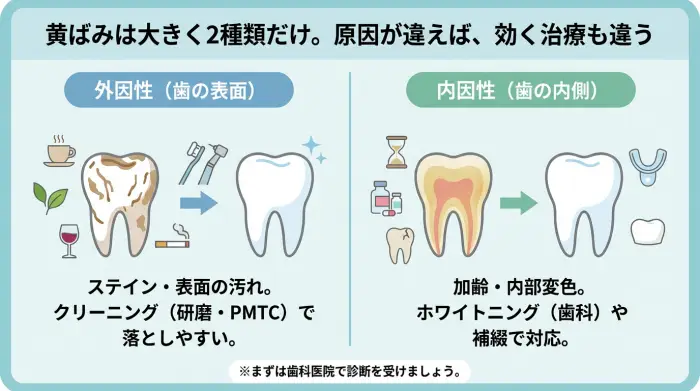 歯の黄ばみは大きく2種類だけ。原因が違えば、効く治療も違う