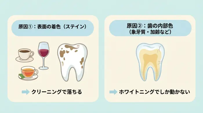黄ばみは「原因別」に分けると迷いが消える