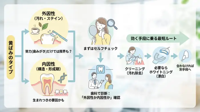 あなたの黄ばみは、努力不足じゃなく“タイプ違い”かもしれない