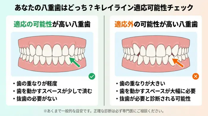八重歯という課題に対し、キレイラインという解決策が万能ではないことを示すため、治療可能な「軽度の八重歯」と治療が難しい「重度の八重歯」のイラストを比較した図解。