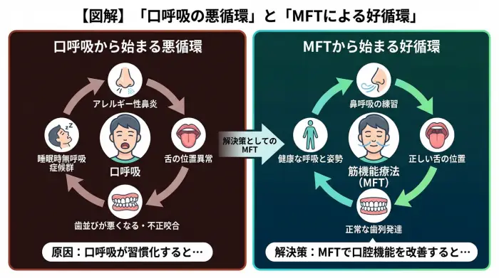 口呼吸の悪循環と筋機能療法（MFT）による好循環を比較した図解。
