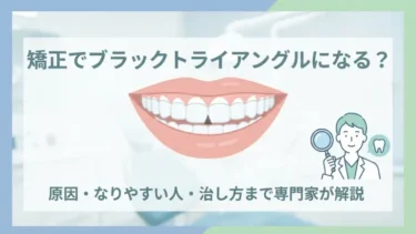 歯列矯正でブラックトライアングルになる？原因・なりやすい人・治し方まで解説