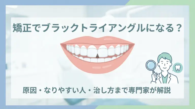 矯正でブラックトライアングルになる？原因・なりやすい人・治し方まで解説