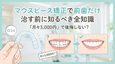 【口コミ】マウスピース矯正で前歯だけ治す前に知るべき全知識｜「月々3,000円」で後悔しない？