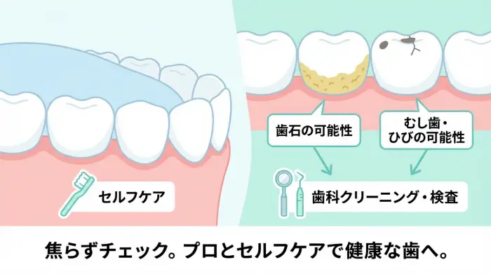 「黄ばみが取れない…」を卒業する前に:まずチェックしたい“歯石”と“むし歯サイン”