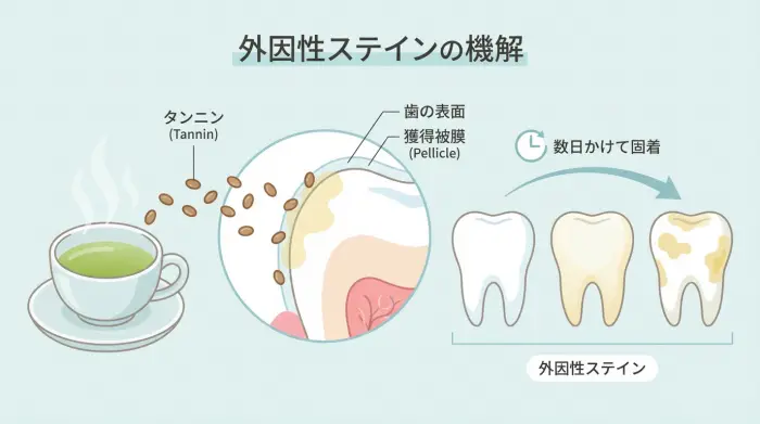 お茶で歯が黄ばむ“本当の仕組み”を知る