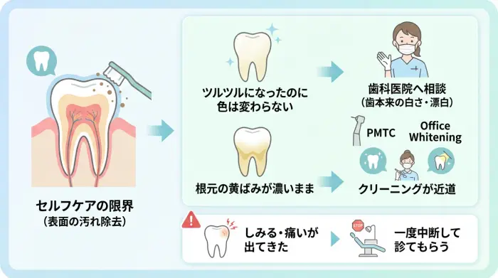 セルフケアの限界とは?白くならない2つの理由と歯科医院へ相談するタイミング
